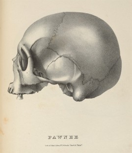 "Crania americana; or, A comparative view of the skulls of various aboriginal nations of North and South America"